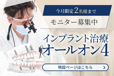 インプラント治療オールオン4